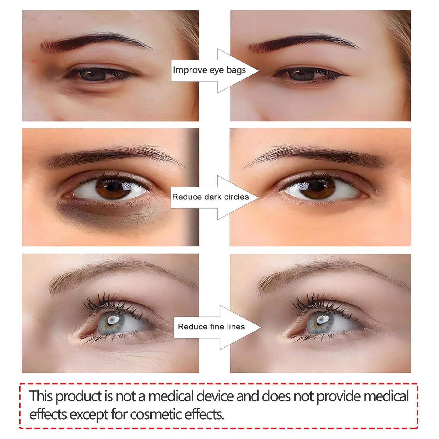 Wireless Anti-Fatigue Eye Massager for Dark Circles & Wrinkles